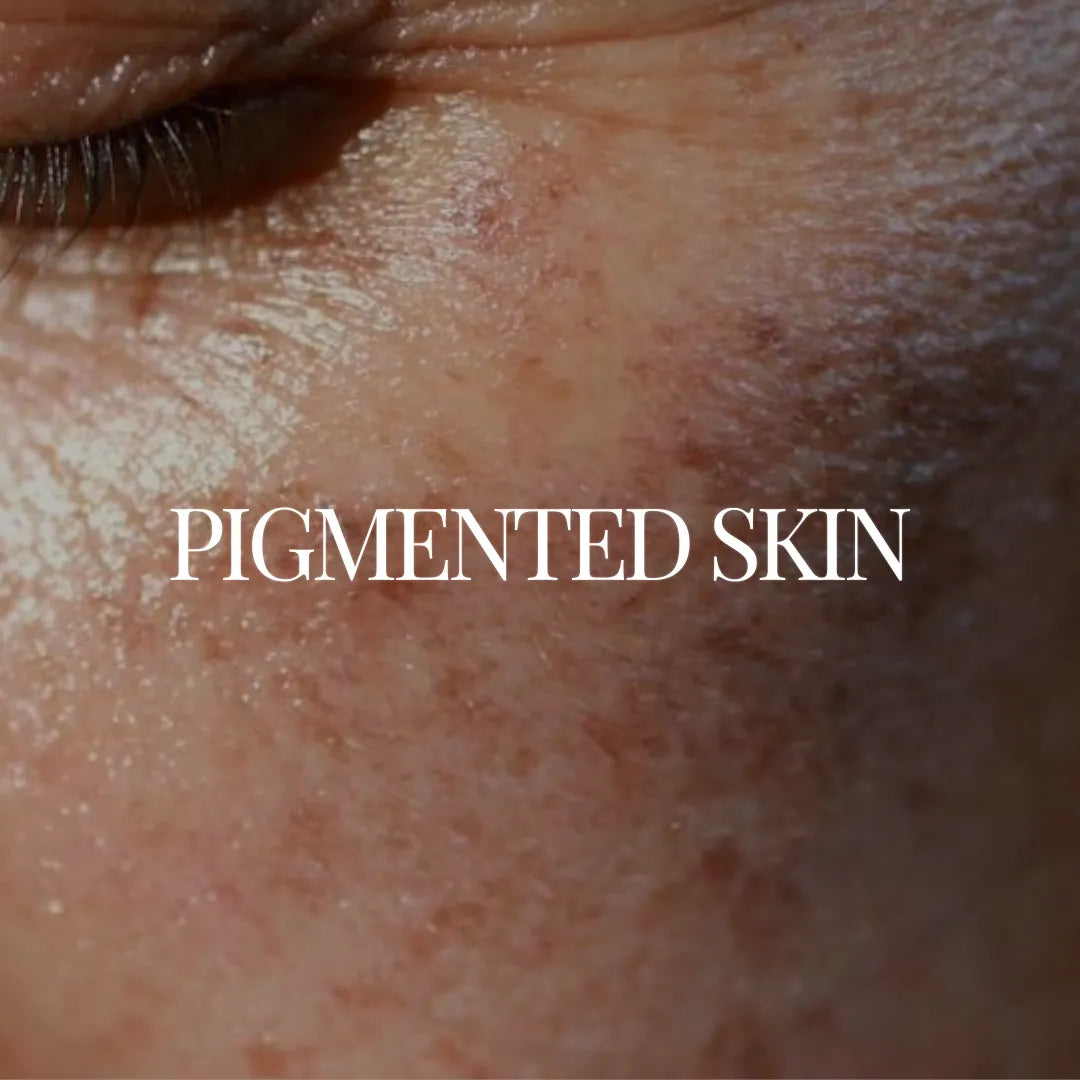 Regimen For Pigmented Skin